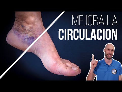 Ejercicios para mejorar la circulación de las piernas con varices