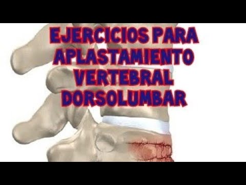 Ejercicios para vertebras aplastadas